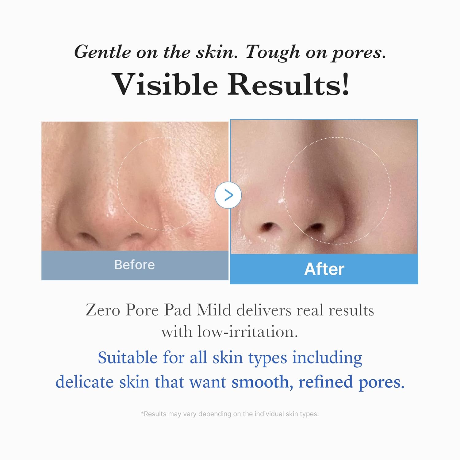 Zero Pore Clarifying Daily Pads